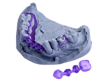 Dental Cast Clean burnout patterns image 2