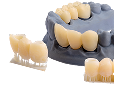 Crown & Bridge Biocompatible crowns image 3