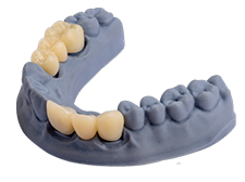 Crown & Bridge Biocompatible crowns image 2
