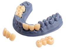 Crown & Bridge Pro Biocompatible long term crowns image 3
