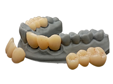 Crown & Bridge Pro Biocompatible long term crowns image 2