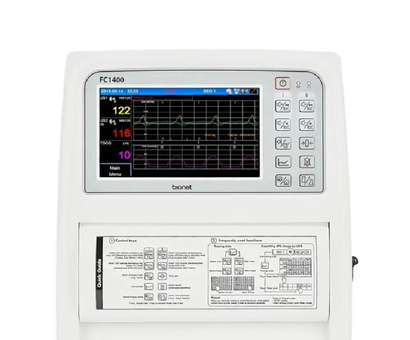 BIONET FC1400 Fetal Monitor (CTG Machine) image 2