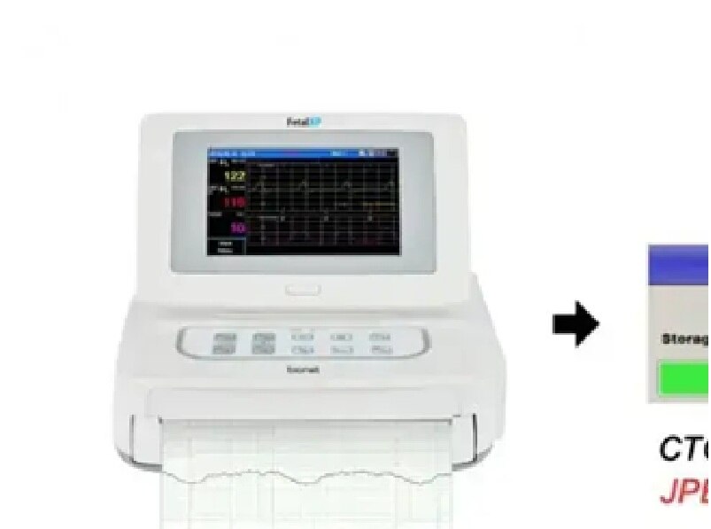 BIONET FC1400 Fetal Monitor (CTG Machine) image 5