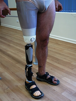Above Knee image 3