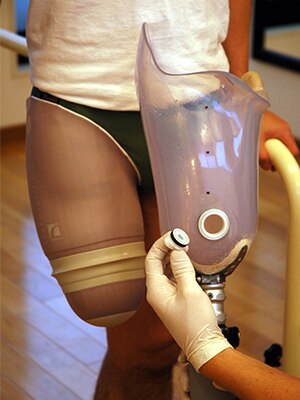 Above Knee image 2