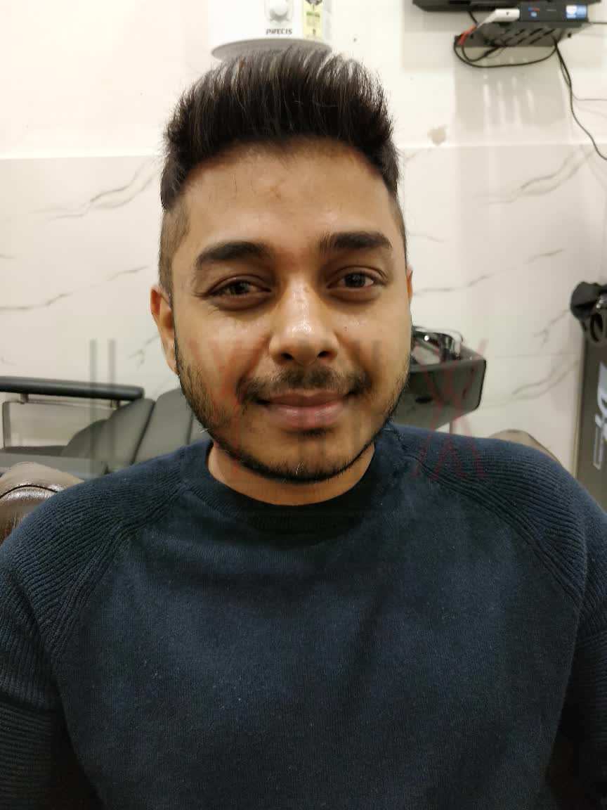 Hair weaving in Pune, Hair replacement in Pune, Hair Fixing and bonding in Pune